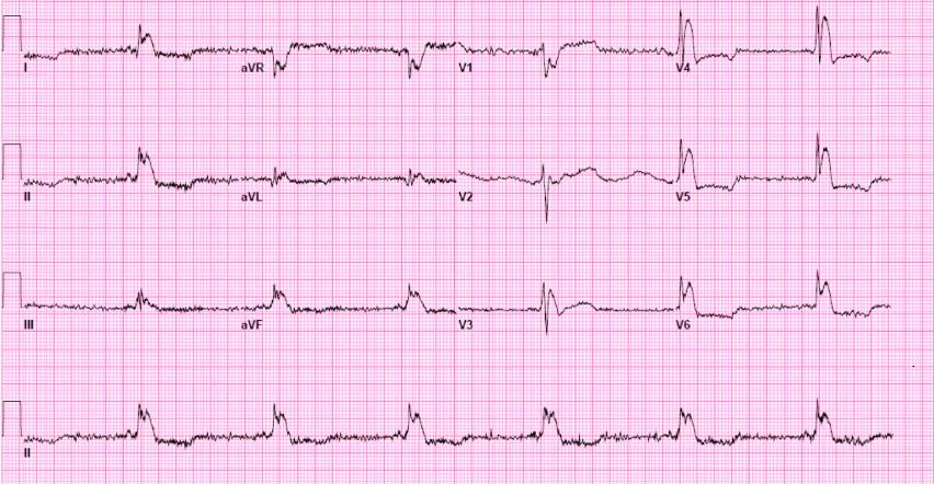 EKGDX - The new era of EKG learning